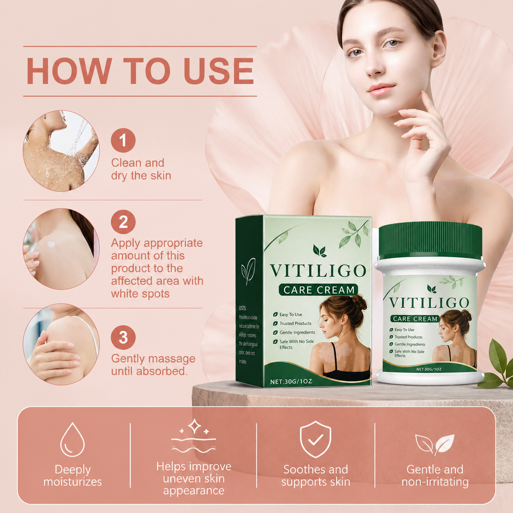 Vitiligo Care Cream – Nourishing Skin Care Formula for Uneven Skin Appearance